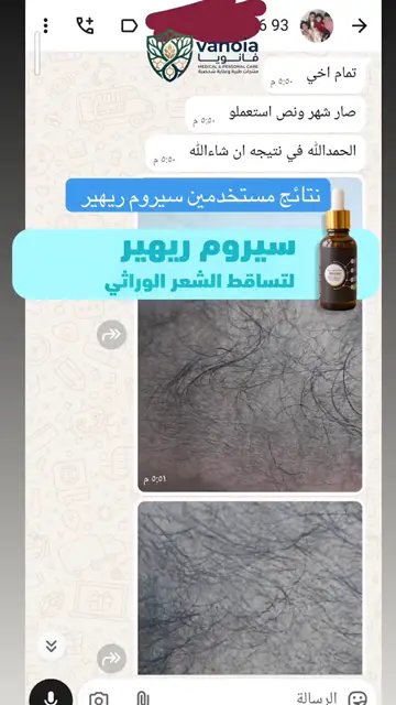 لقطة شاشة واتساب من تجربة عميل رقم 6