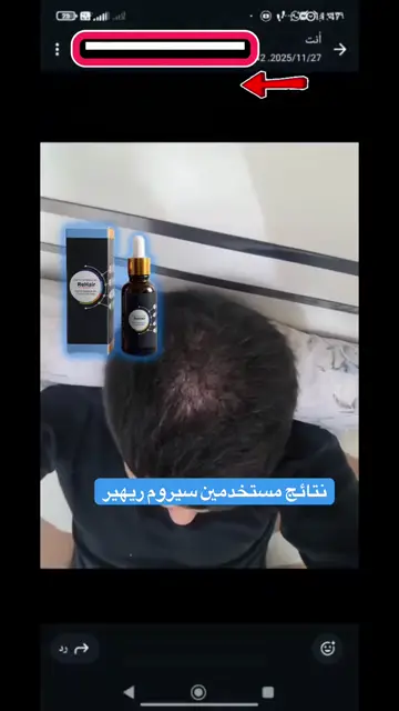 لقطة شاشة واتساب من تجربة عميل رقم 22