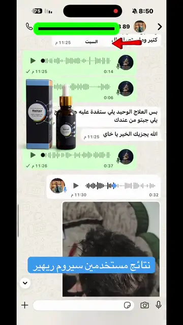 لقطة شاشة واتساب من تجربة عميل رقم 44