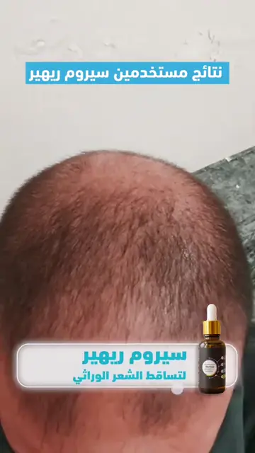 لقطة شاشة واتساب من تجربة عميل رقم 2