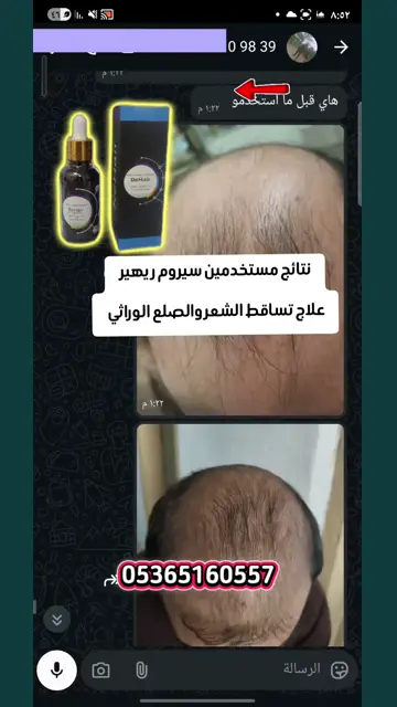 لقطة شاشة واتساب من تجربة عميل رقم 54