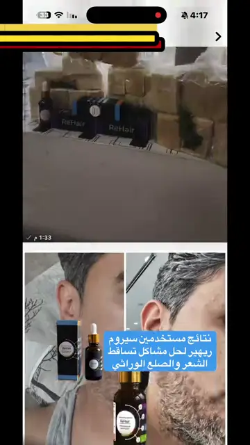 لقطة شاشة واتساب من تجربة عميل رقم 17