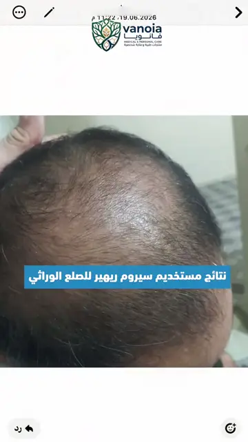 لقطة شاشة واتساب من تجربة عميل رقم 20