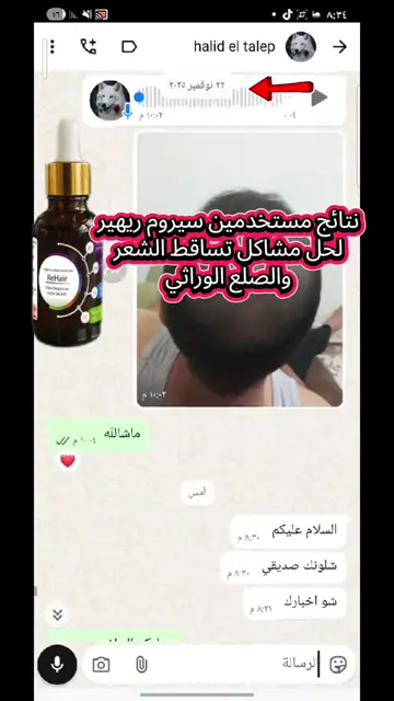 لقطة شاشة واتساب من تجربة عميل رقم 45