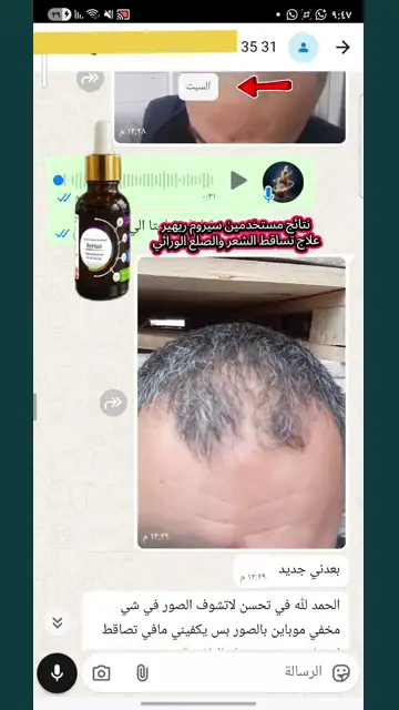 لقطة شاشة واتساب من تجربة عميل رقم 16