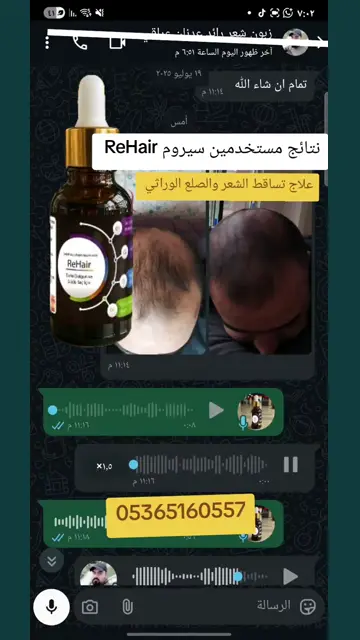 لقطة شاشة واتساب من تجربة عميل رقم 12