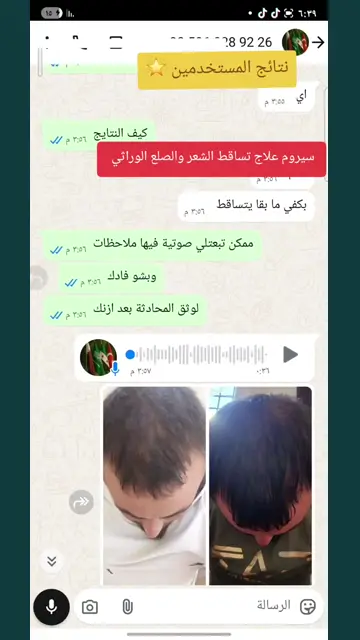 لقطة شاشة واتساب من تجربة عميل رقم 59