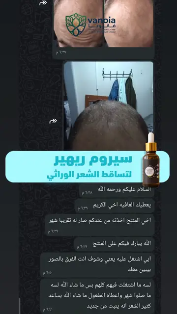 لقطة شاشة واتساب من تجربة عميل رقم 47