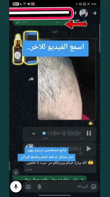 لقطة شاشة واتساب من تجربة عميل رقم 14