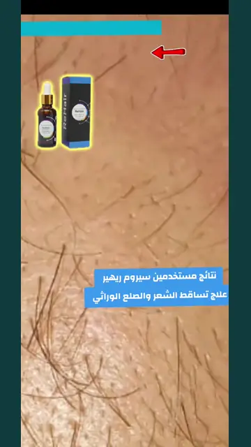 لقطة شاشة واتساب من تجربة عميل رقم 11