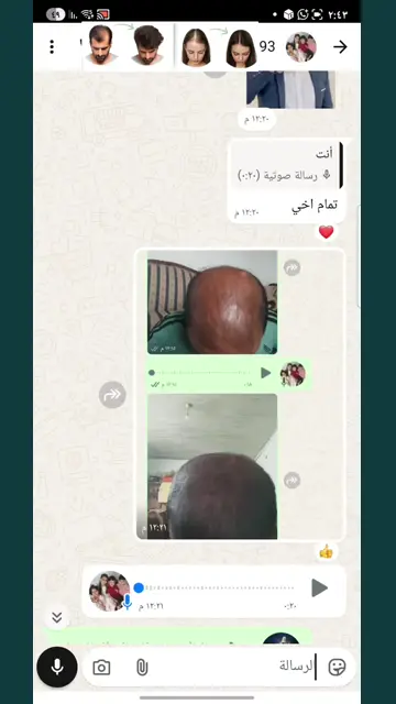 لقطة شاشة واتساب من تجربة عميل رقم 28