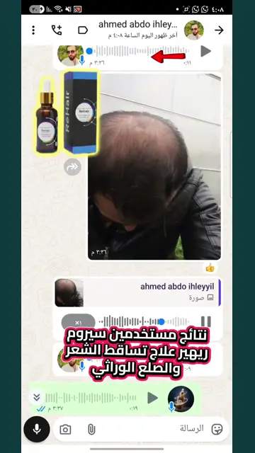 لقطة شاشة واتساب من تجربة عميل رقم 41