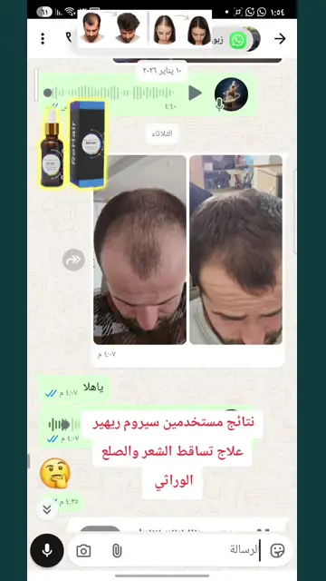 لقطة شاشة واتساب من تجربة عميل رقم 56