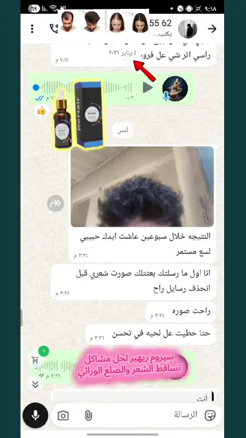 لقطة شاشة واتساب من تجربة عميل رقم 32