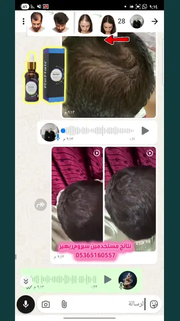لقطة شاشة واتساب من تجربة عميل رقم 38