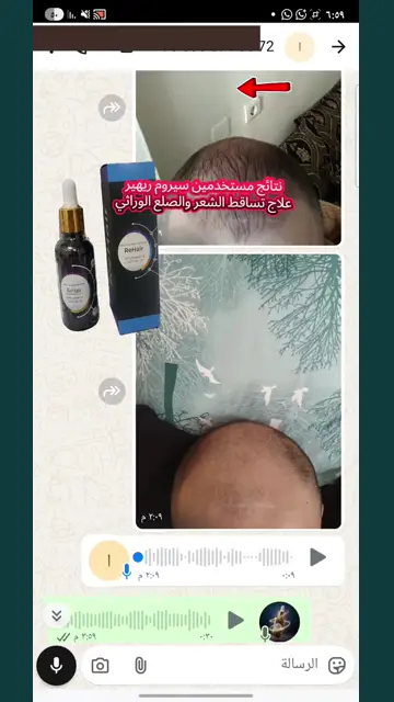 لقطة شاشة واتساب من تجربة عميل رقم 39