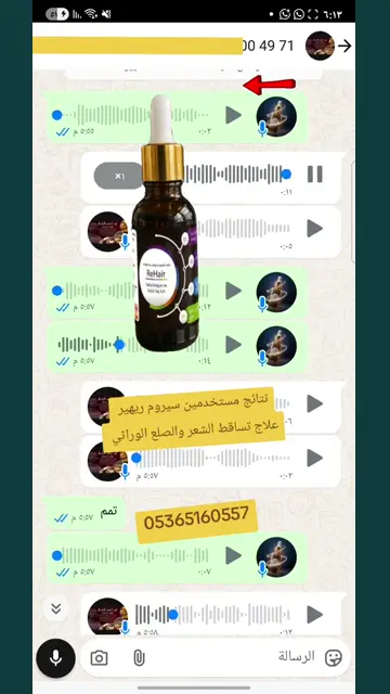 لقطة شاشة واتساب من تجربة عميل رقم 15
