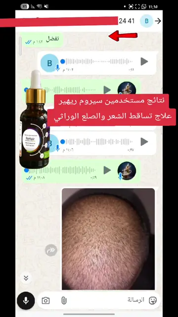 لقطة شاشة واتساب من تجربة عميل رقم 60