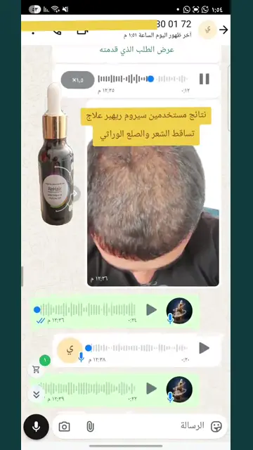 لقطة شاشة واتساب من تجربة عميل رقم 24