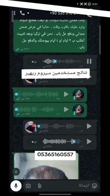 لقطة شاشة واتساب من تجربة عميل رقم 21