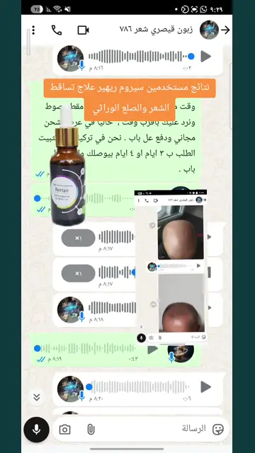 لقطة شاشة واتساب من تجربة عميل رقم 30
